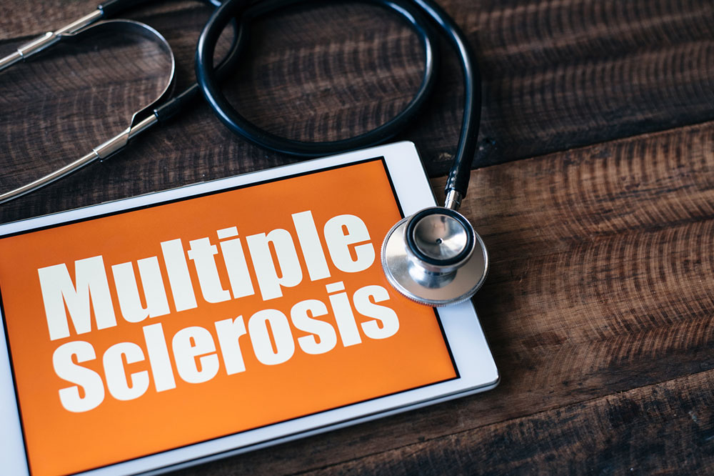 Essential Insights into Multiple Sclerosis and Its Management