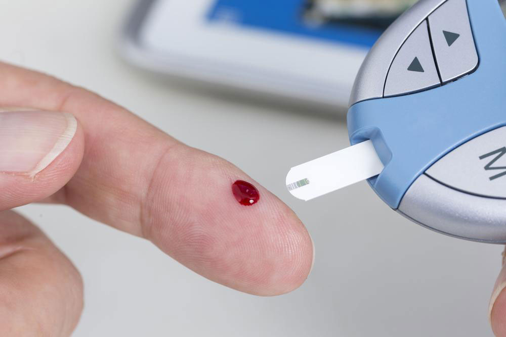 Essential Insights into Blood Glucose Levels and Management