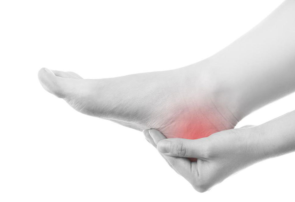Effective Strategies for Managing Gout: Top 5 Treatments to Consider