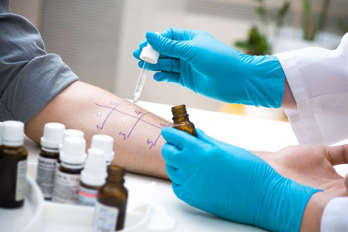 Distinguishing Allergies from Serious Conditions: What You Need to Know