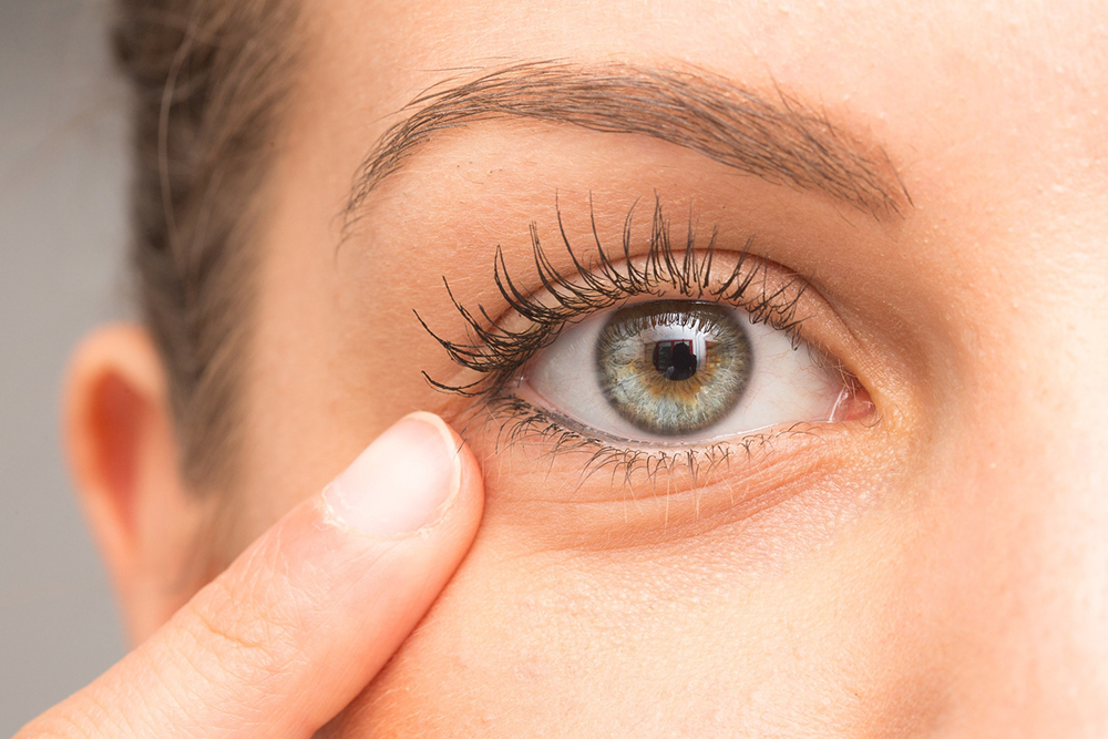 Comprehensive Guide to Eye Twitching: Causes, Types, and Practical Remedies
