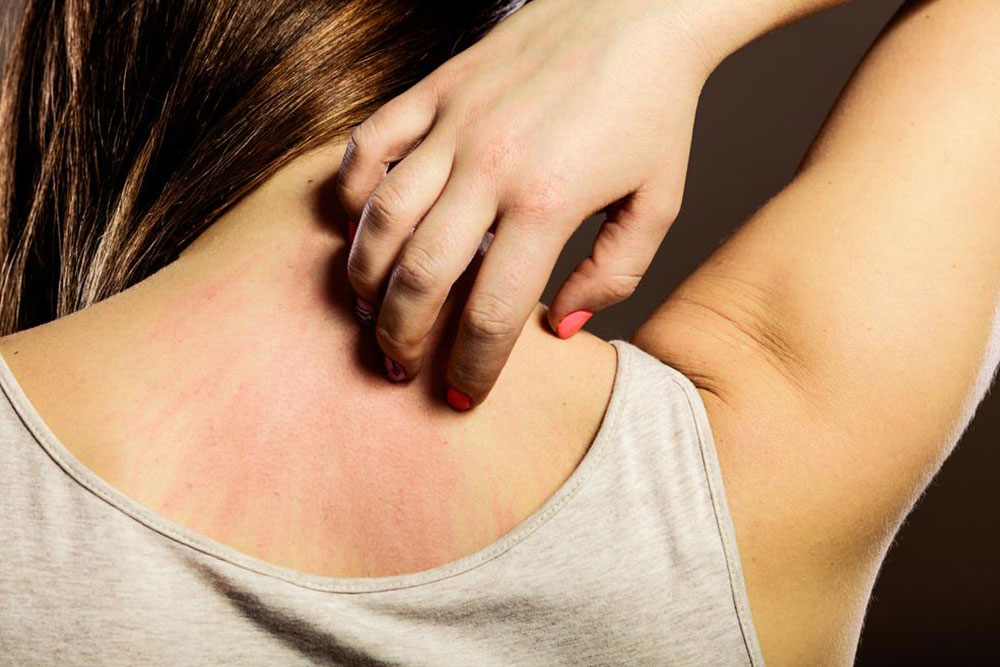 Understanding and Managing Seasonal Allergies