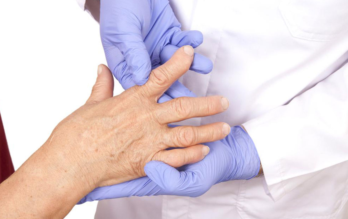 Comprehensive Guide to Different Types of Arthritis