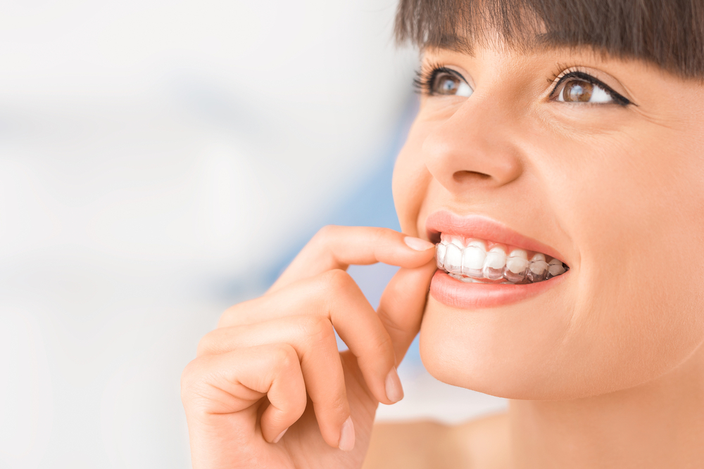 Effective Solutions for Overcrowded Teeth and Their Importance