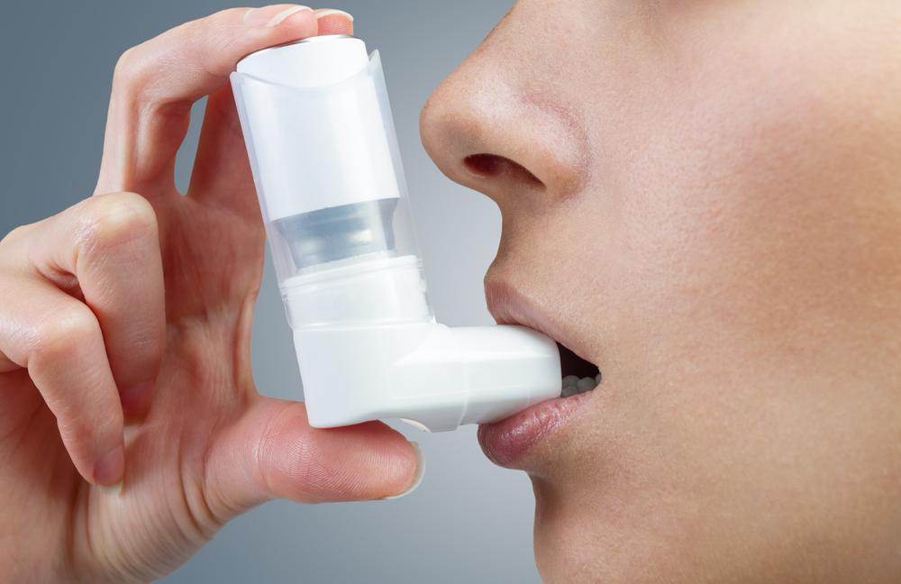 Effective Strategies for Managing Severe Asthma