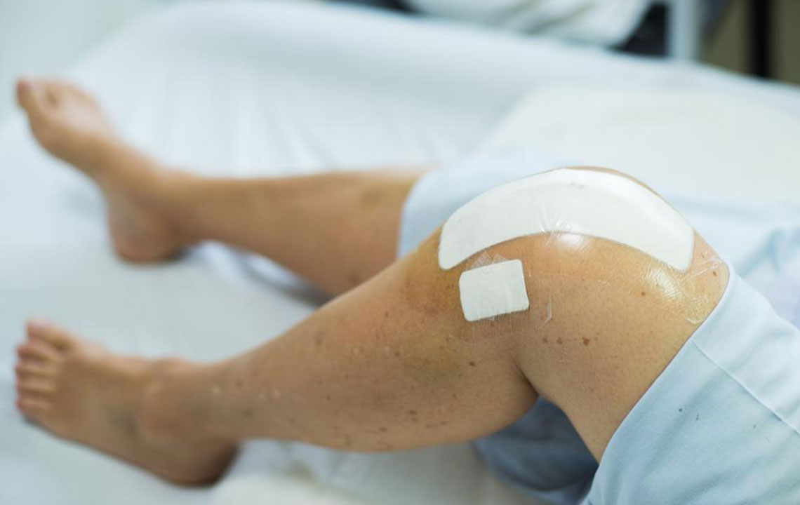 Understanding Knee Replacement Surgery: Causes, Types, and Preparation