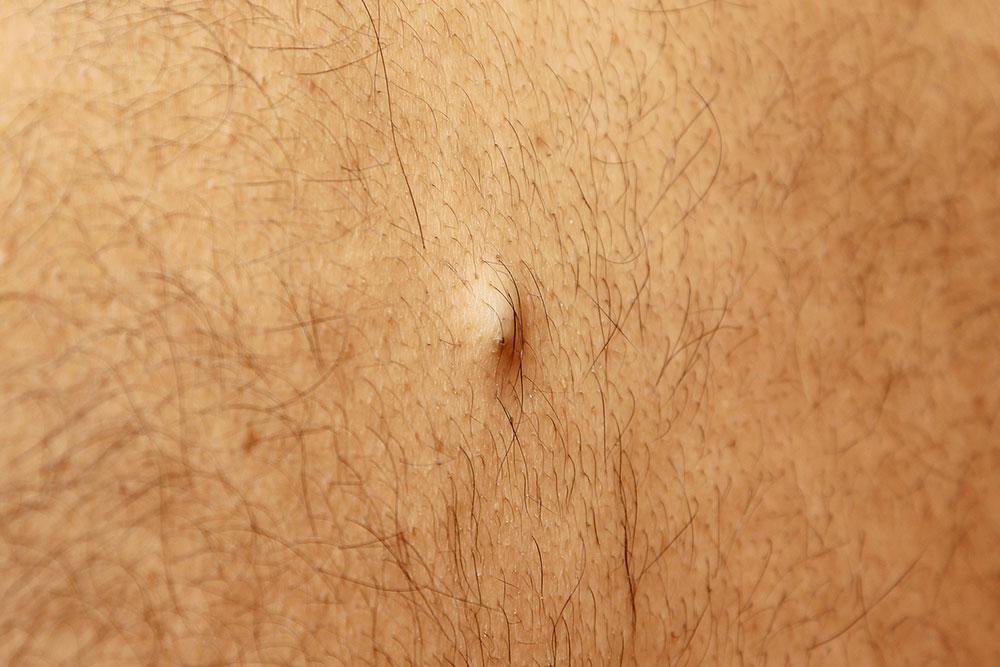 Understanding and Recognizing Signs of Ingrown Hair