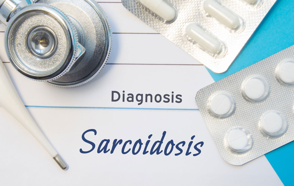 Comprehensive Insights into the Causes and Risk Factors of Sarcoidosis