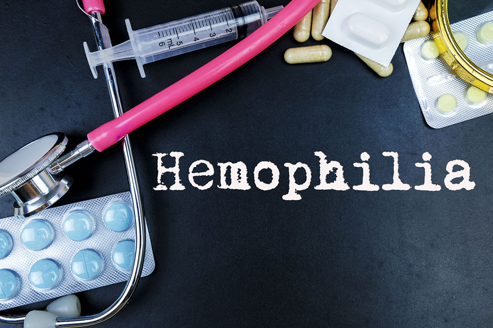Top 6 Treatment Strategies for Managing Hemophilia