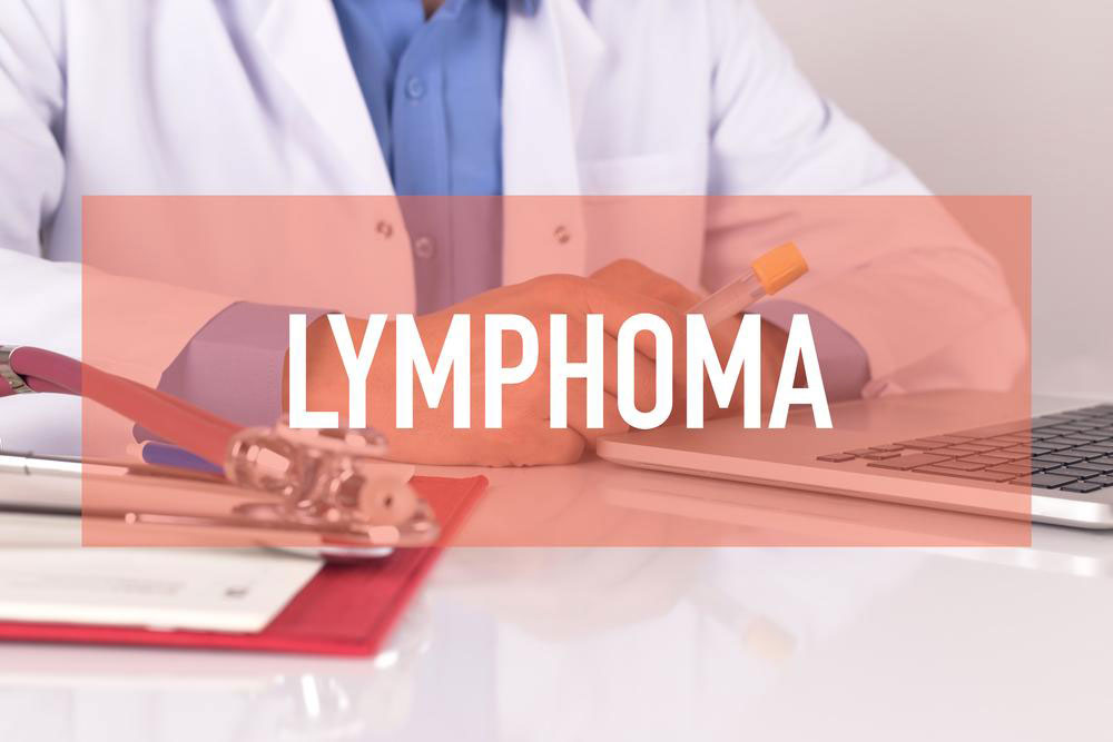 Understanding Non-Hodgkin Lymphoma: Symptoms, Causes, and Treatment Options