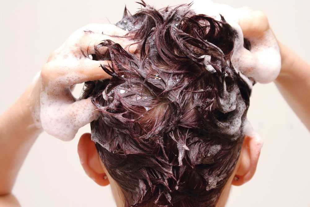 Effective Home Remedies to Heal Seborrheic Dermatitis on the Scalp
