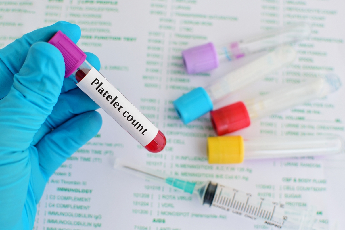 Effective Strategies for Managing Thrombocytopenia and Low Platelet Counts