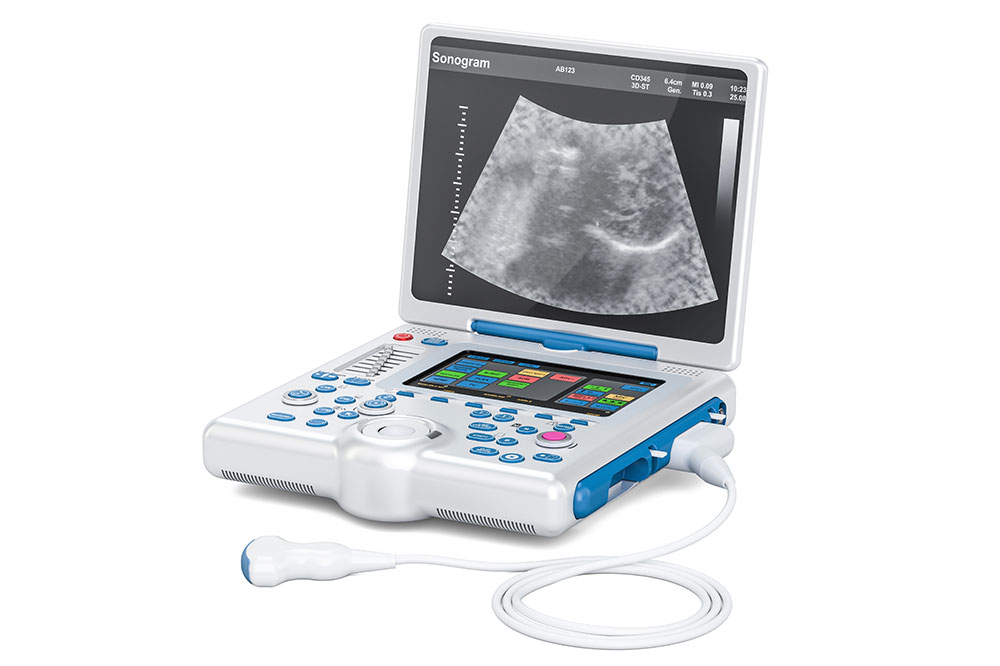 Top 5 Innovative Portable Ultrasound Devices Transforming Medical Diagnostics in 2024