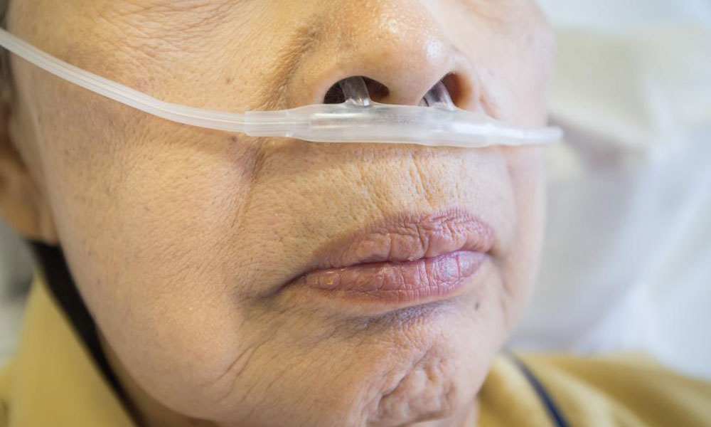 Top Natural Home Strategies for Managing COPD Symptoms
