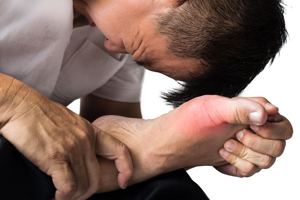 Understanding Gout Flare-Ups and Their Effects