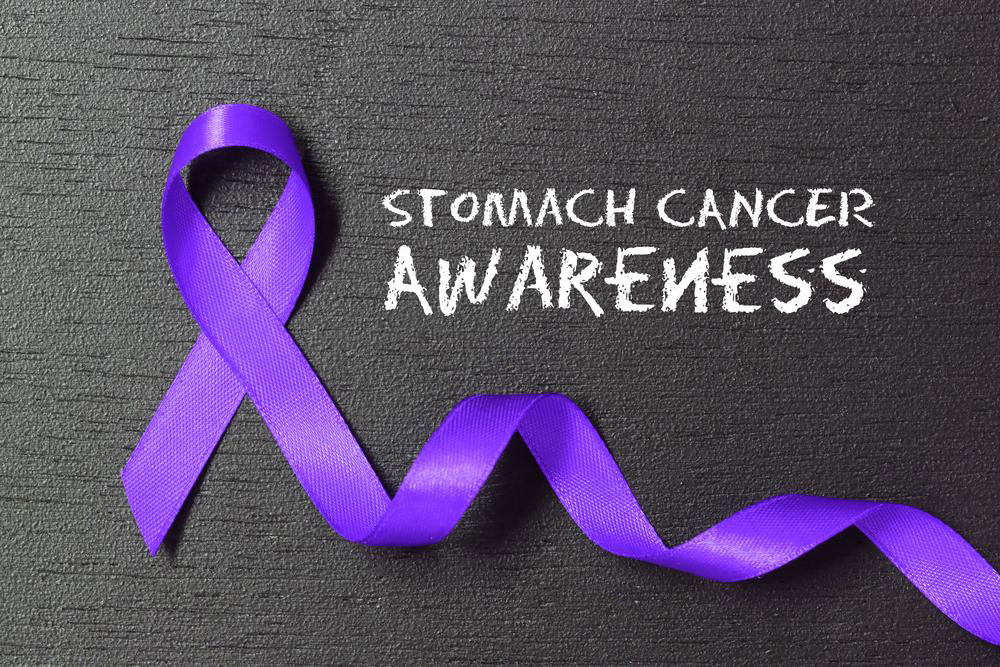Comprehensive Guide to Gastric Cancer: Recognizing Symptoms, Causes, and Treatment Options