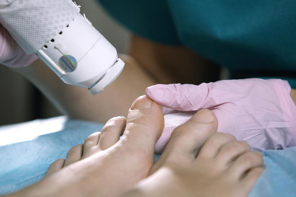 Identifying Common Fungal Infections and Their Symptoms