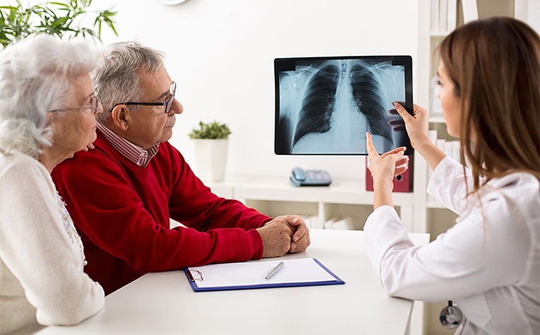 Understanding Lung Cancer: Types and Progression Stages