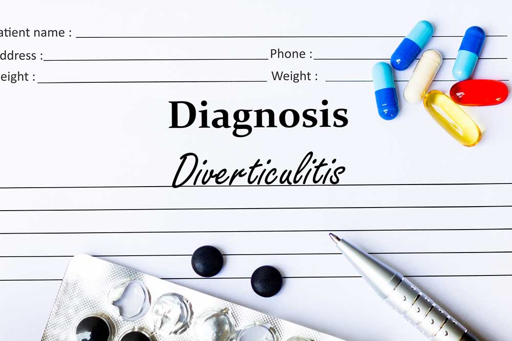 Top 7 Probiotic Foods to Support Diverticulitis Recovery