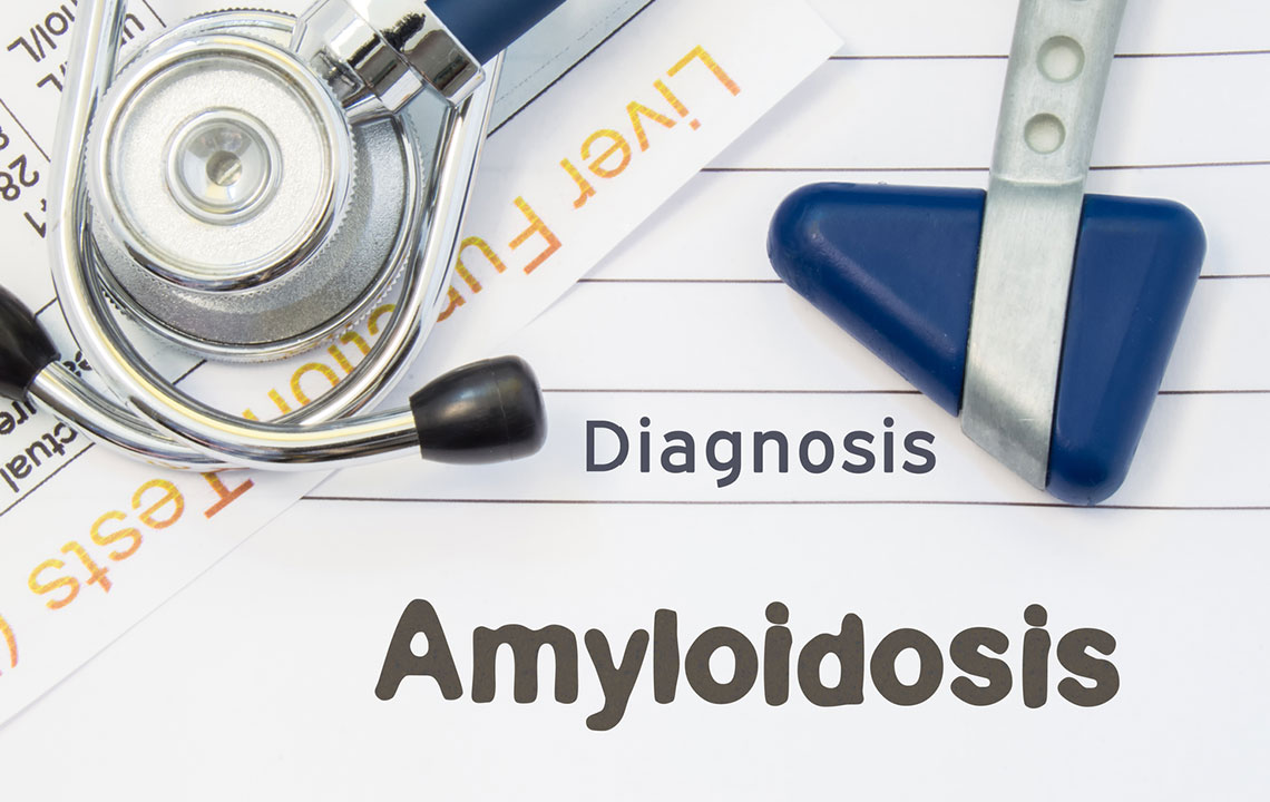 Understanding the Variations and Types of Amyloidosis