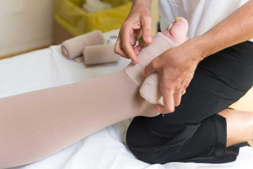 Understanding Leg Swelling: Causes and Effective Treatments