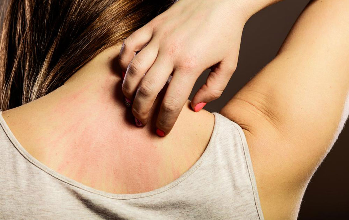 Recognizing Early Signs of Lupus: Key Symptoms to Watch For