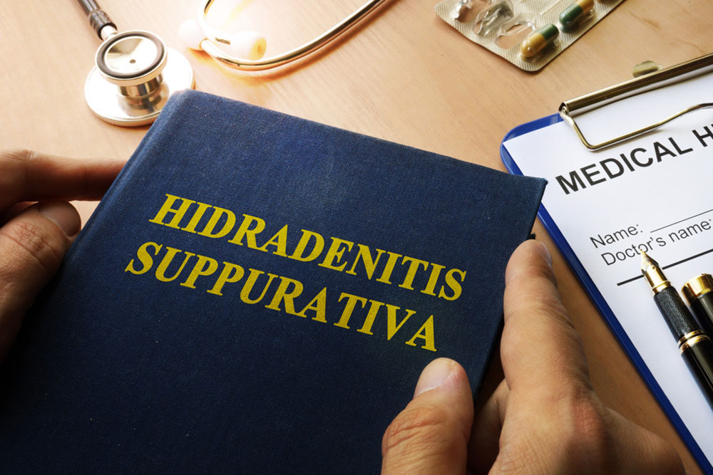Understanding Hidradenitis Suppurativa: Causes, Symptoms, and Treatment