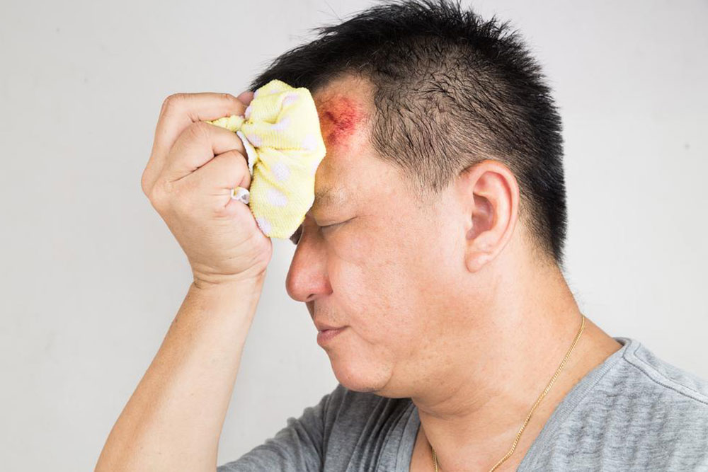 Effective Strategies for Managing a Head Injury