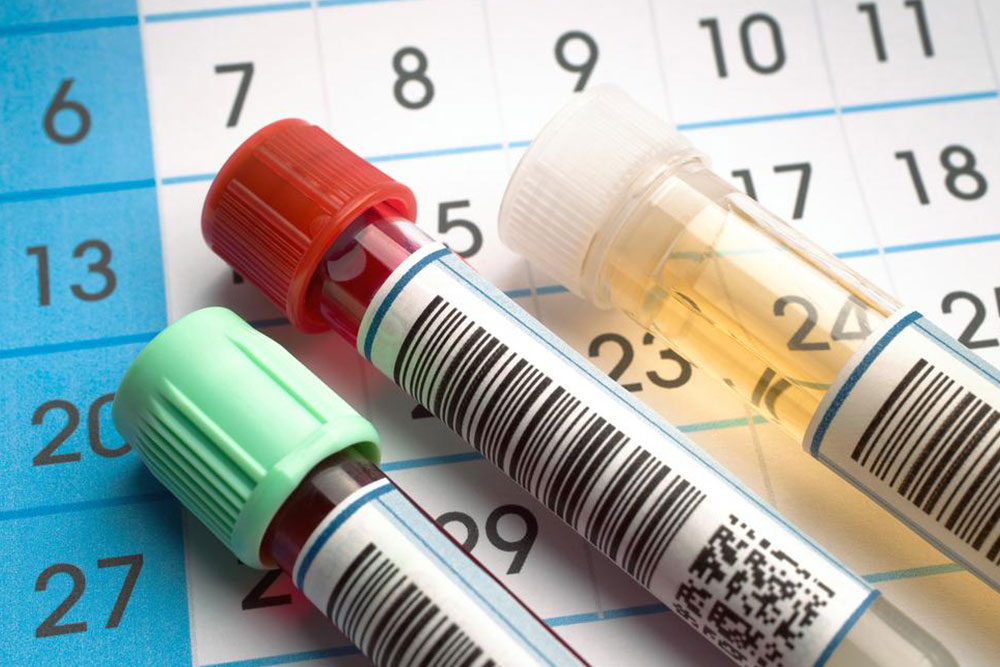 Effective Home Treatments for Visible Blood in Urine