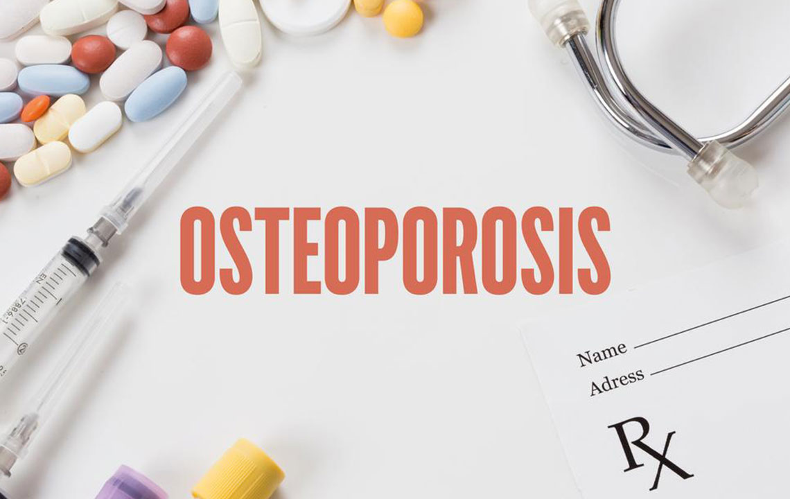 10 Essential Tips to Prevent and Reverse Osteoporosis