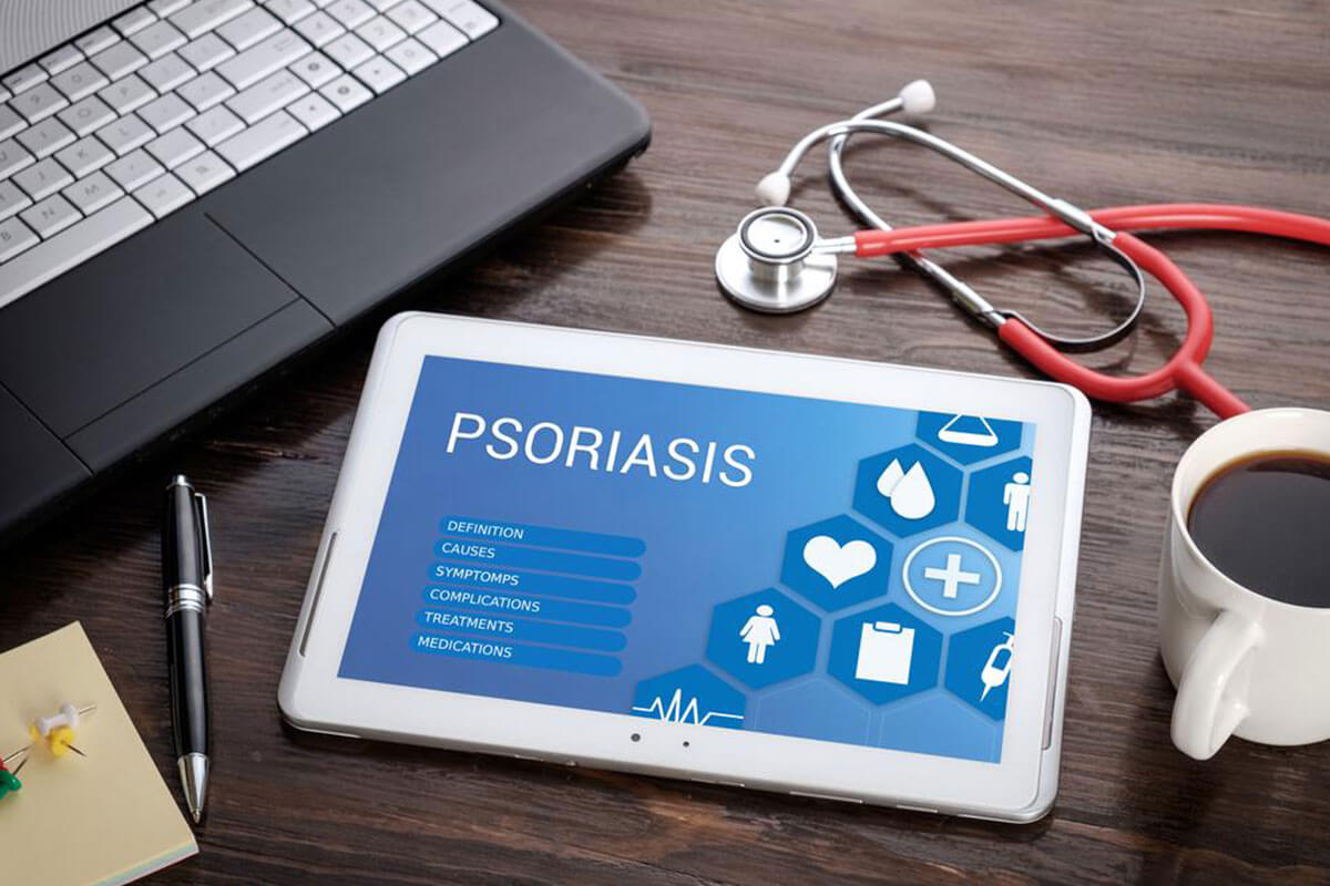 Natural Home Remedies for Managing Psoriasis Symptoms