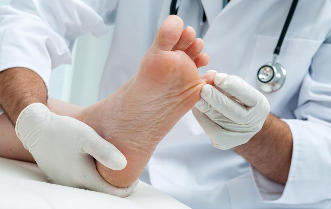 Comprehensive Guide to Using Listerine as a Natural Remedy for Toenail Fungal Infections