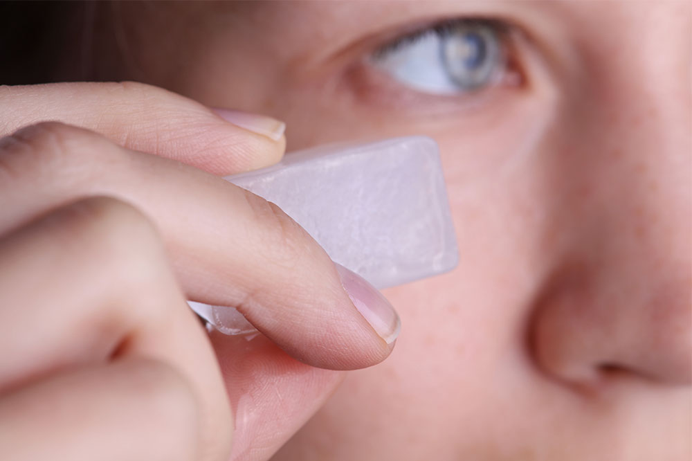 Comprehensive Natural Strategies for Accelerating Black Eye Healing