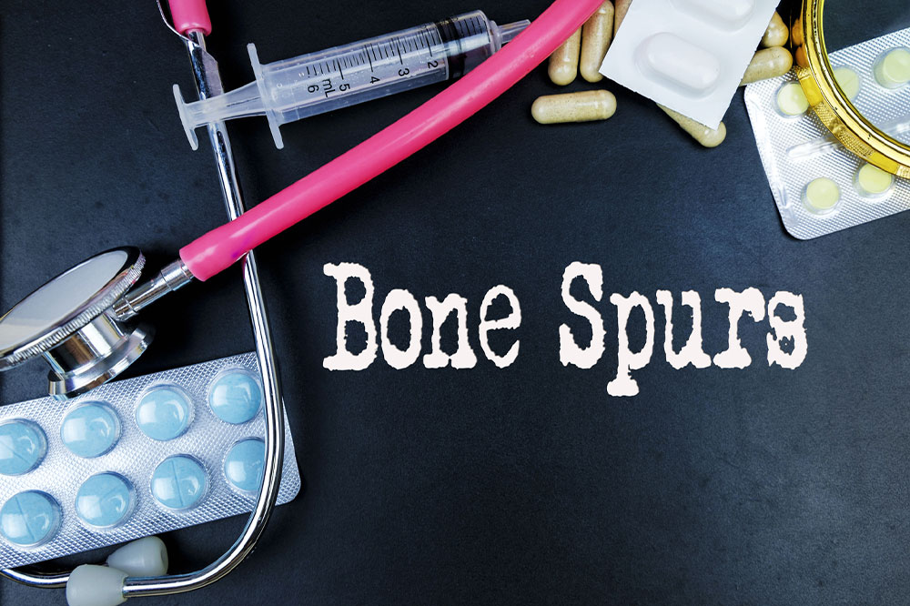 Understanding Bone Spurs: Causes, Types, and Treatment Options