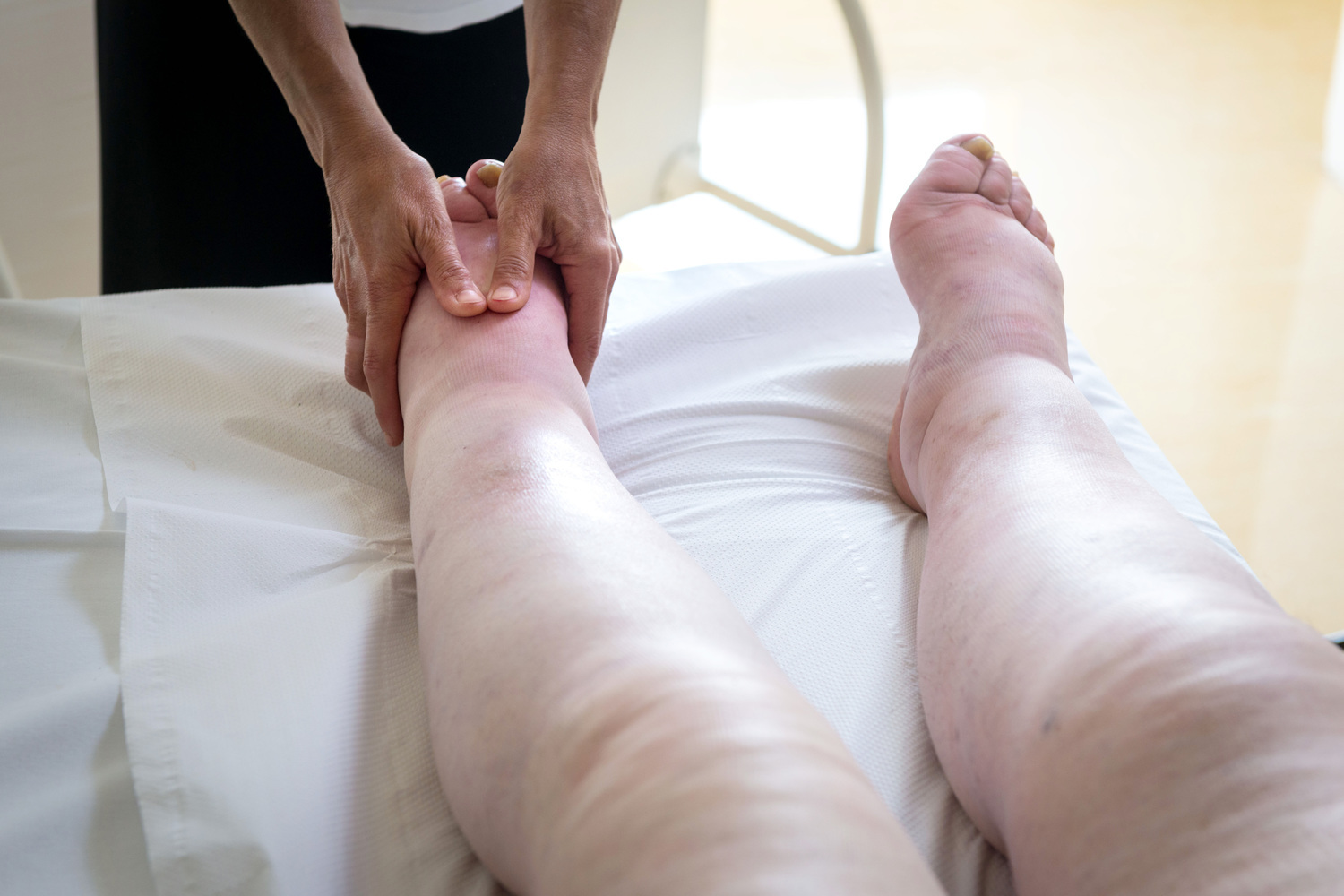 Comprehensive Home Remedies to Relieve Swollen Feet and Ankles