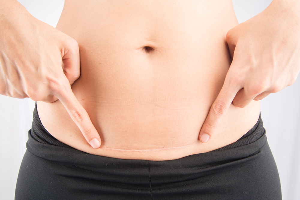 Key Facts About Recovering Postpartum Body Changes