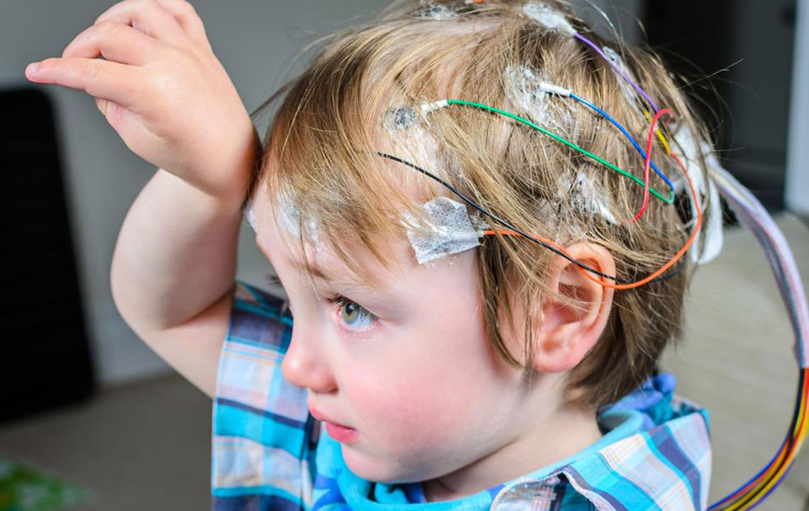Understanding Seizures: Symptoms, Causes, and Treatment Options