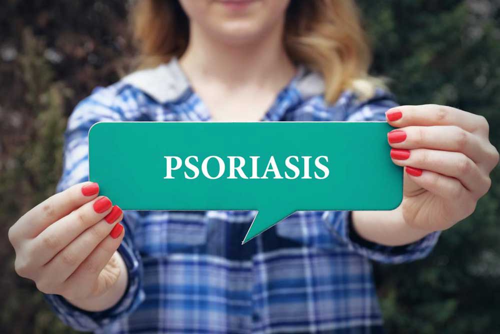 Effective Home Strategies for Managing Plaque Psoriasis