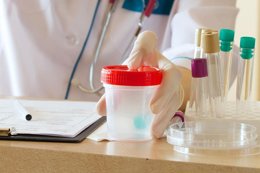Understanding Proteinuria: The Urine Protein Test Explained