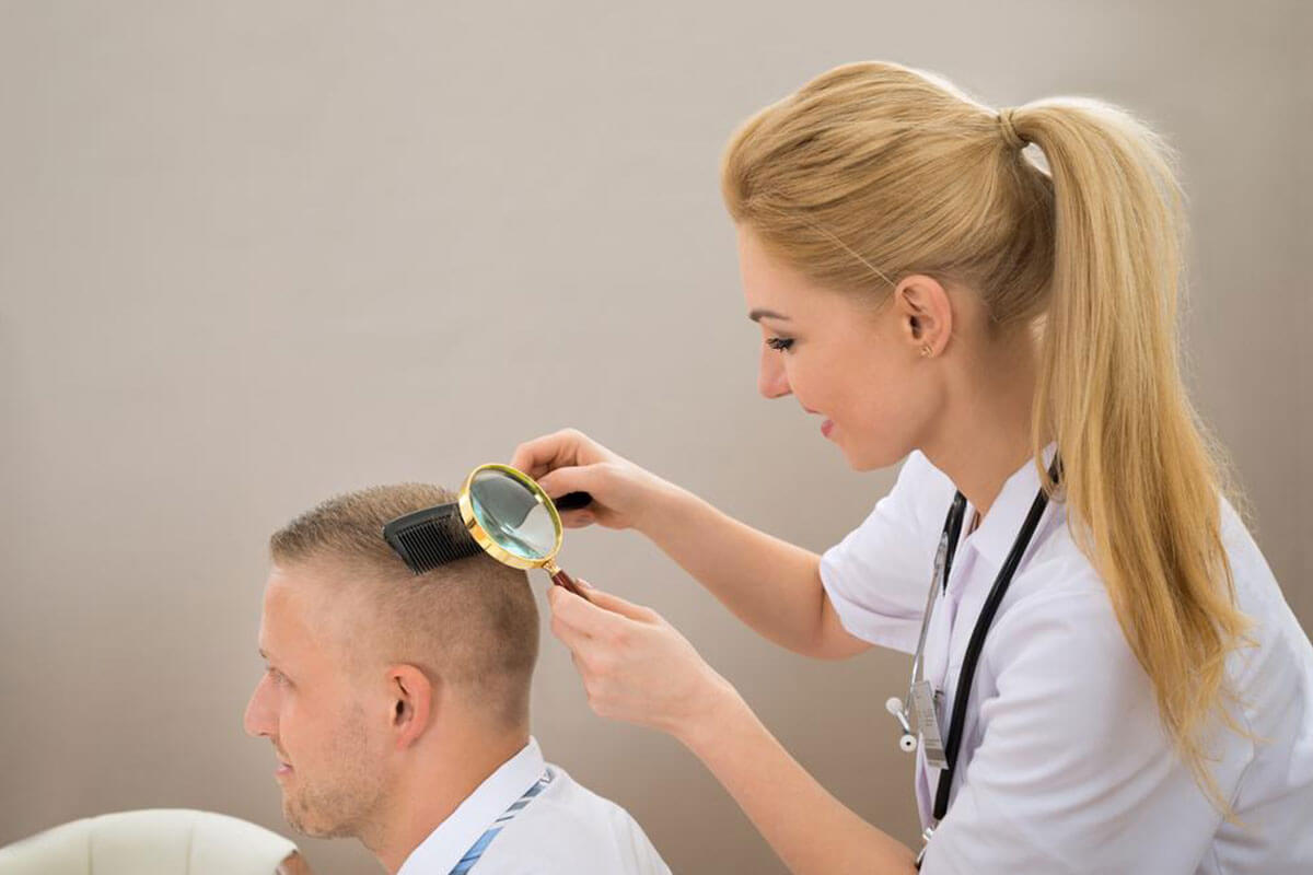Effective Strategies to Manage and Reduce Scalp Psoriasis
