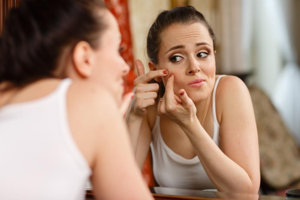 Effective Strategies to Manage Adult Acne