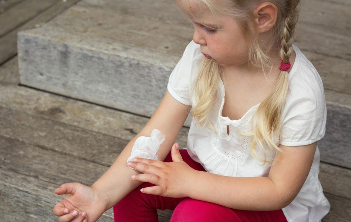 Effective Home Strategies for Managing Atopic Dermatitis