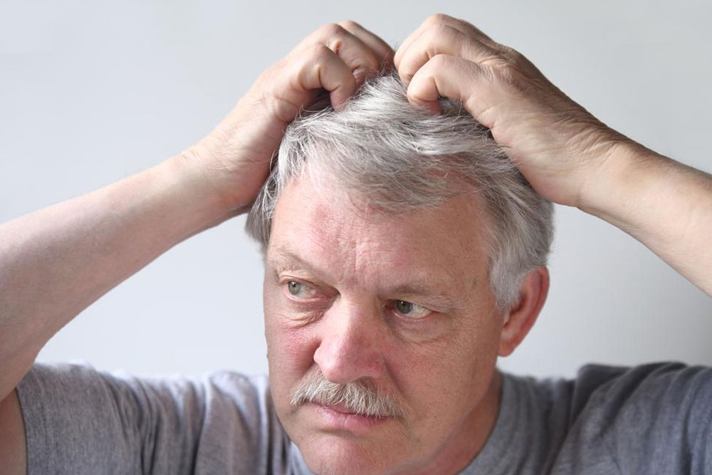 Comprehensive Guide to Understanding and Managing Psoriasis