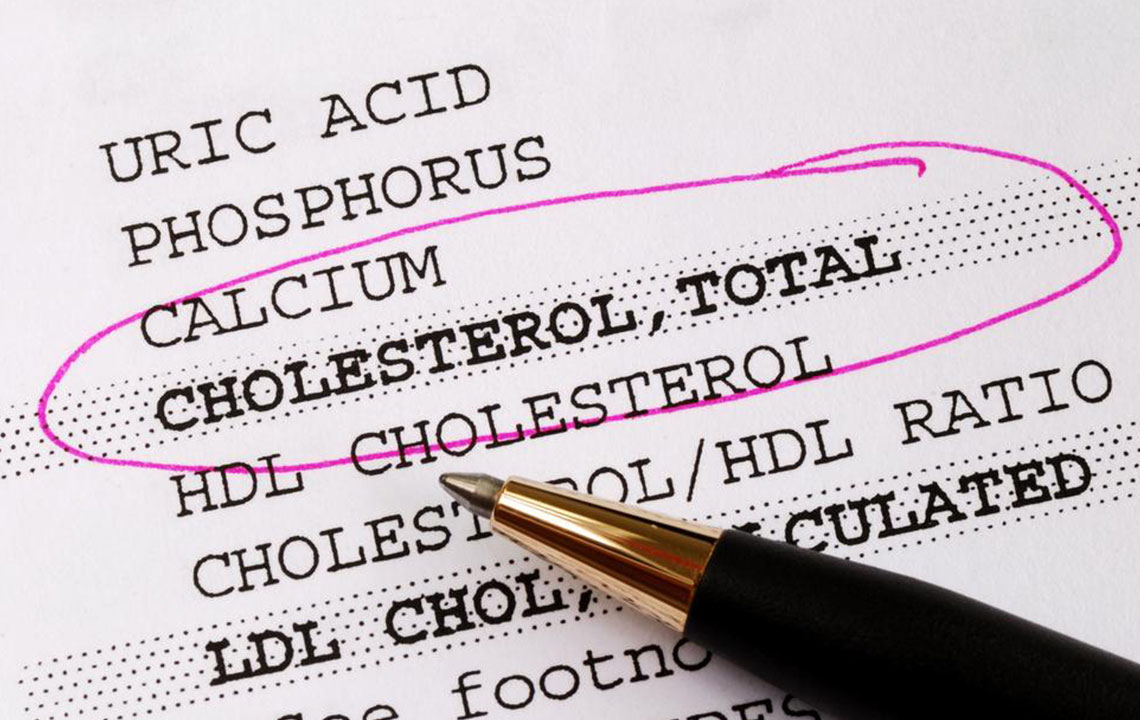 Essential Insights on Managing Cholesterol Levels