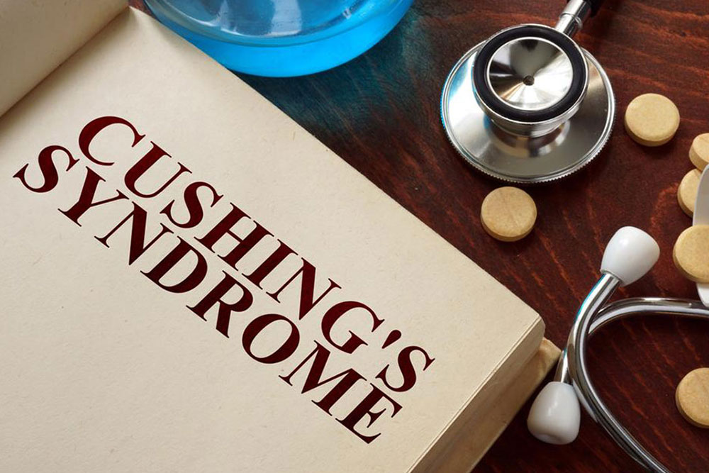 Identifying Symptoms of Cushing's Disease
