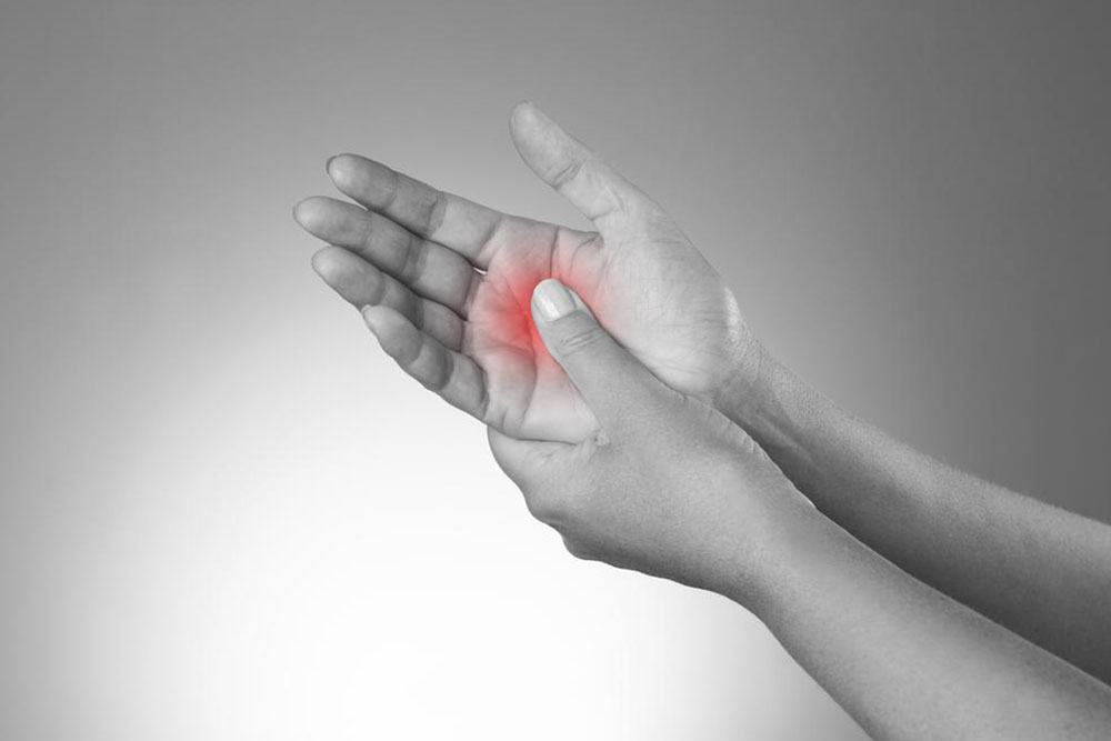 Comprehensive Treatment Strategies for Dupuytren's Contracture