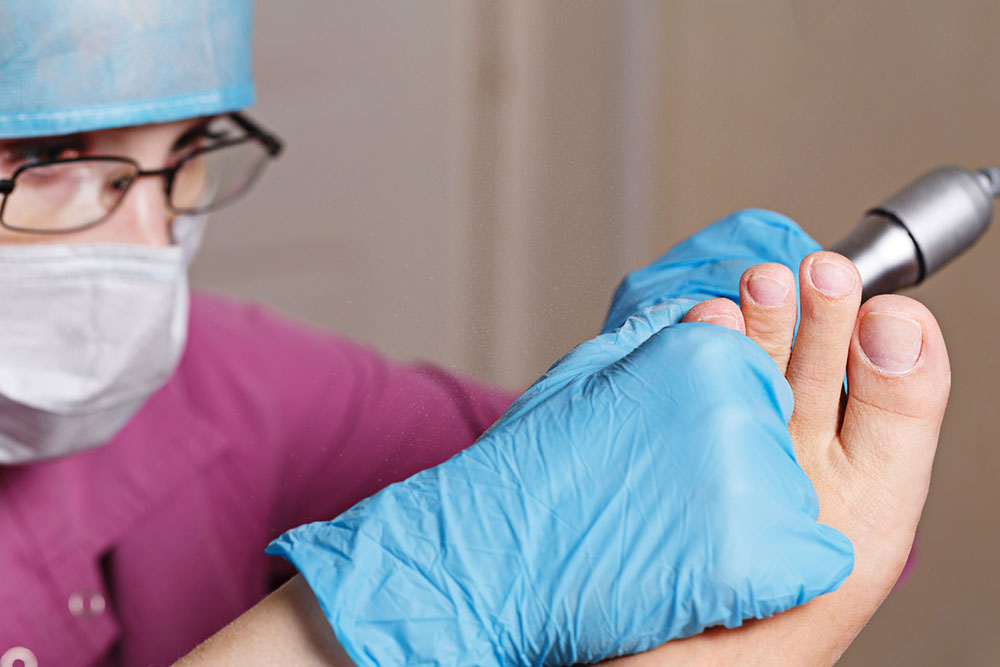 Effective Ways to Eliminate Corns and Calluses