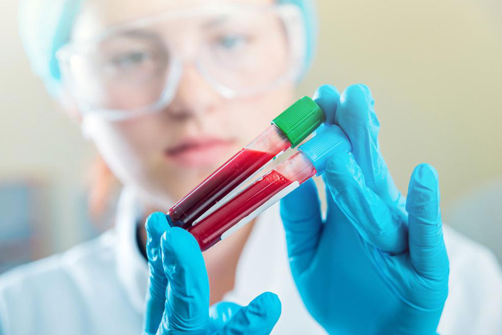 Importance of Keeping Creatinine Levels within Normal Range