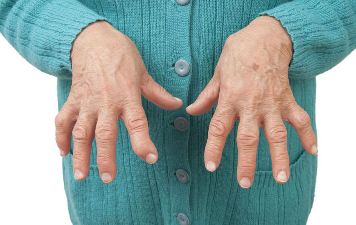Understanding Different Types of Arthritis and How to Manage Them