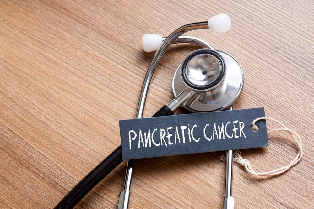 Understanding Pancreatic Cancer: Symptoms and Treatment Options